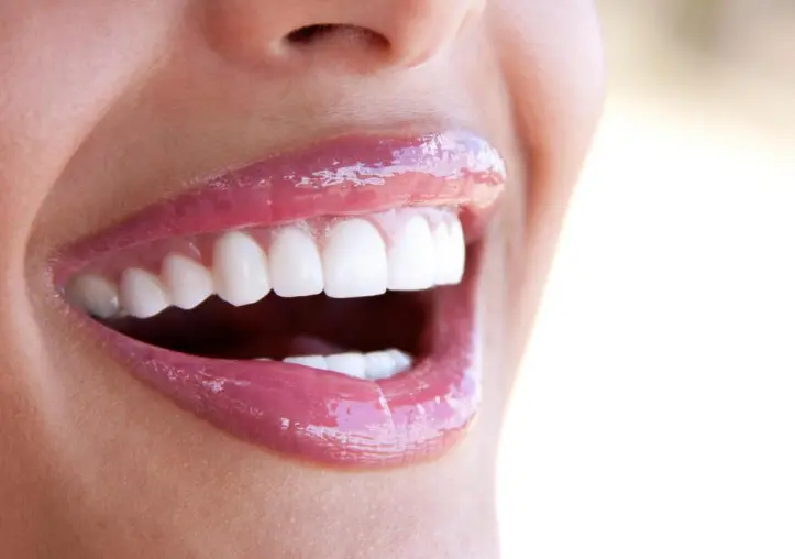 Ways to Whiten your teeth