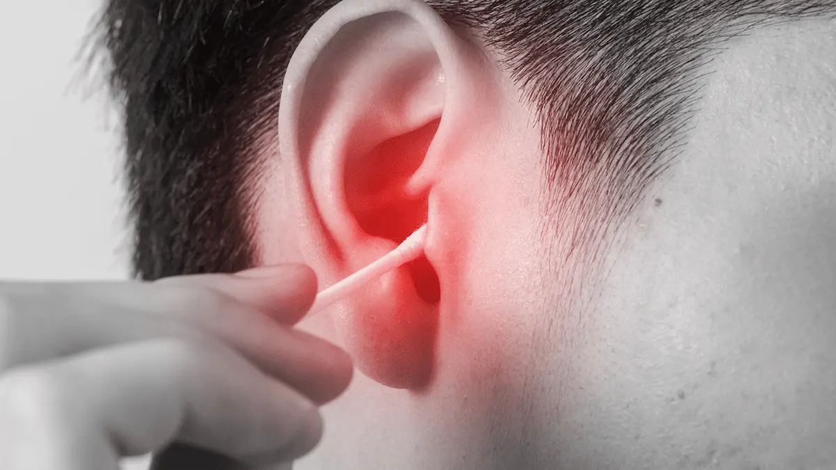 Ear infections and their treatment