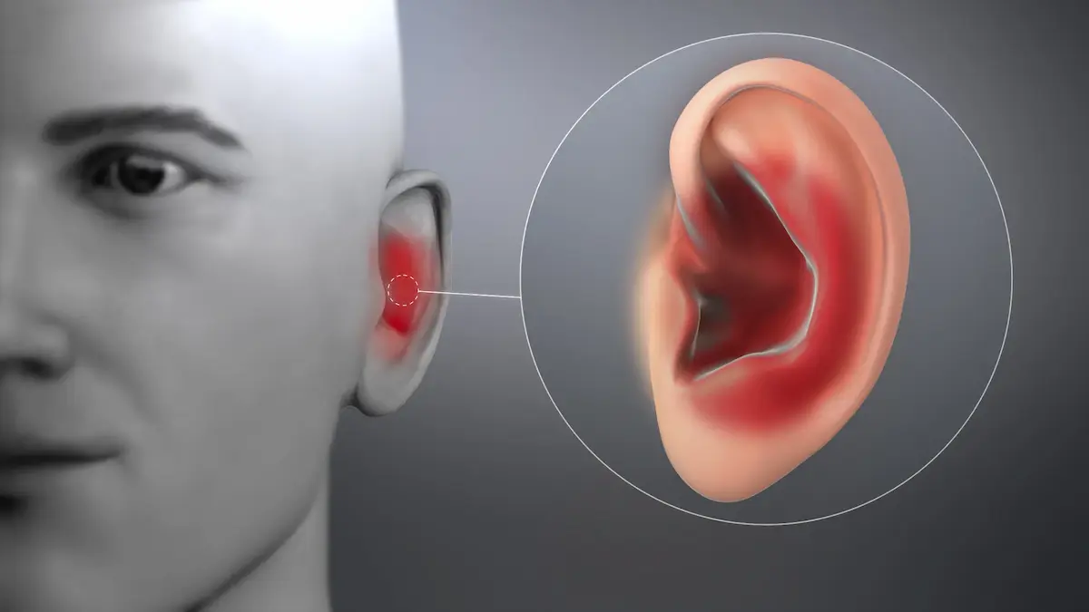 Ear infections and their treatment