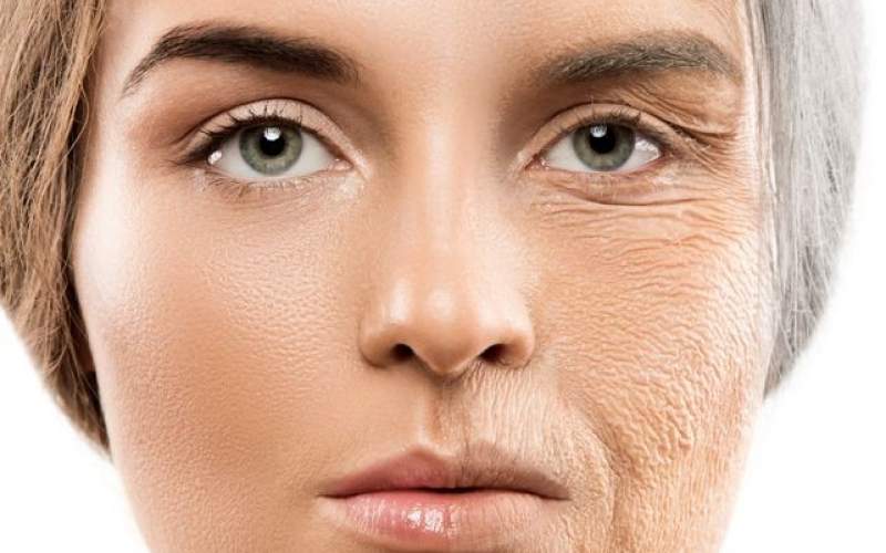 How to decrease wrinkles