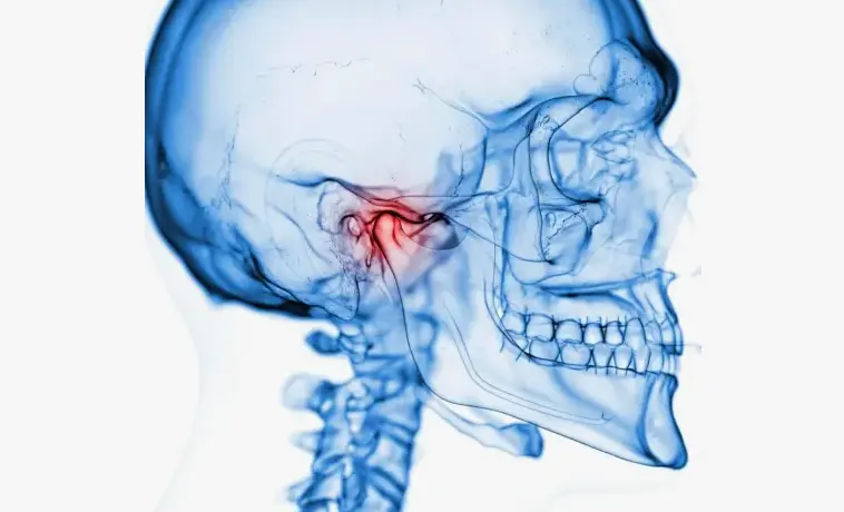 TMJ disorder and treatment