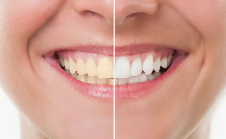 cosmetic dentistry procedures