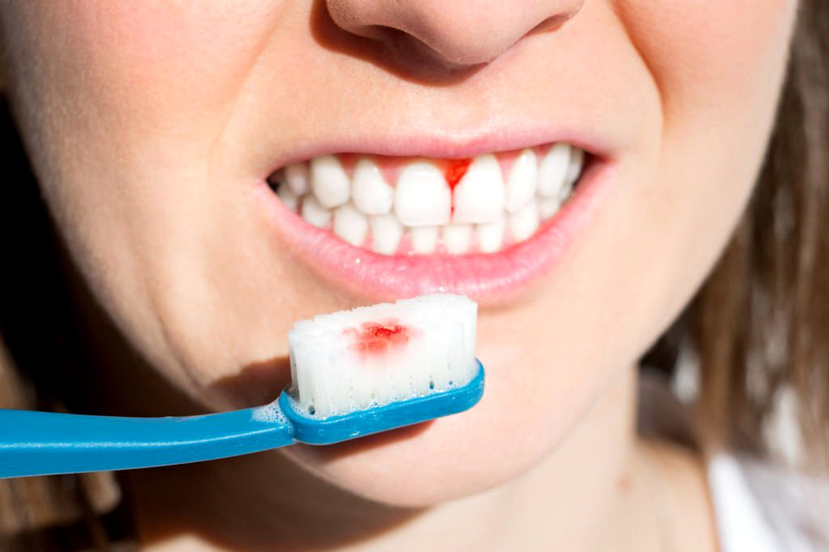 how to prevent gum disease in adults