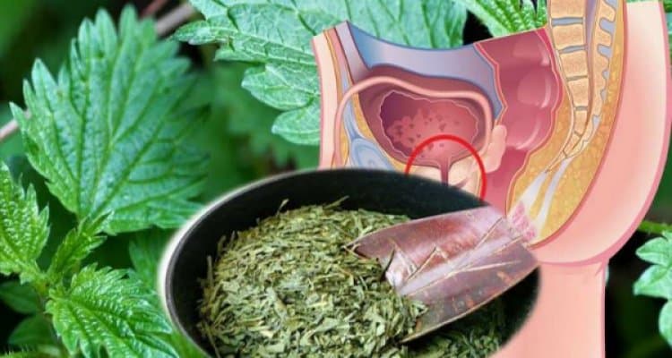 Herbal Remedies for Prostate Care