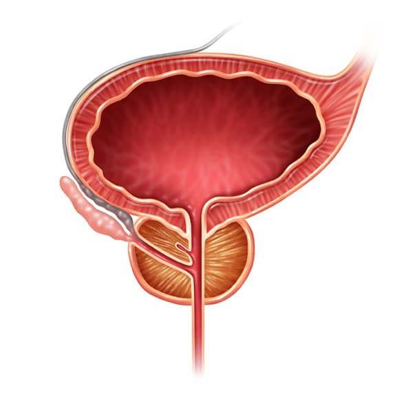 Prostatic Fluid 